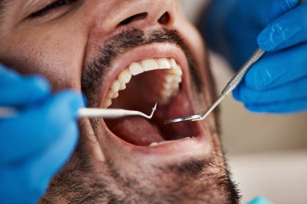 Best Pediatric Emergency Dentist in Whiskey Creek, FL
